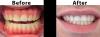Cosmetic Dental Work